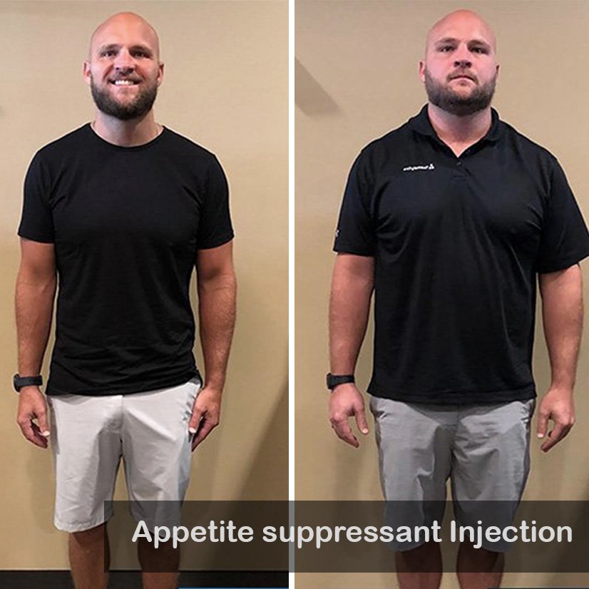 Appetite suppressant Injection-1