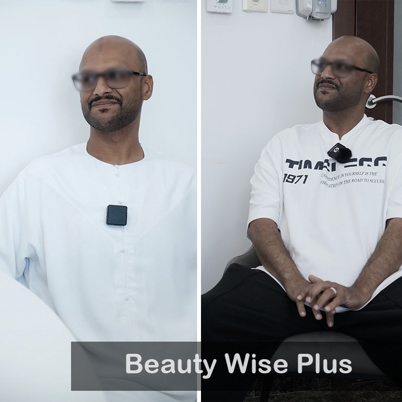 Case 01 Beauty wise Plus