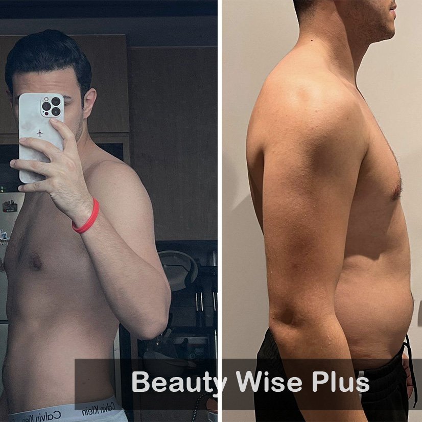 Case 02 Beauty wise Plus