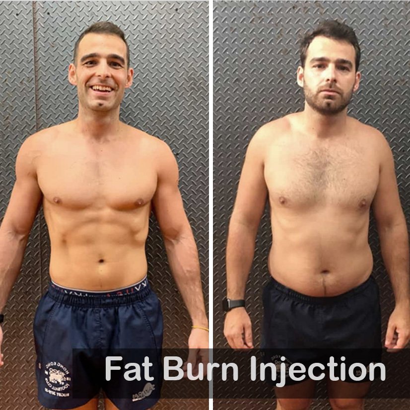 Fat Burn Injection