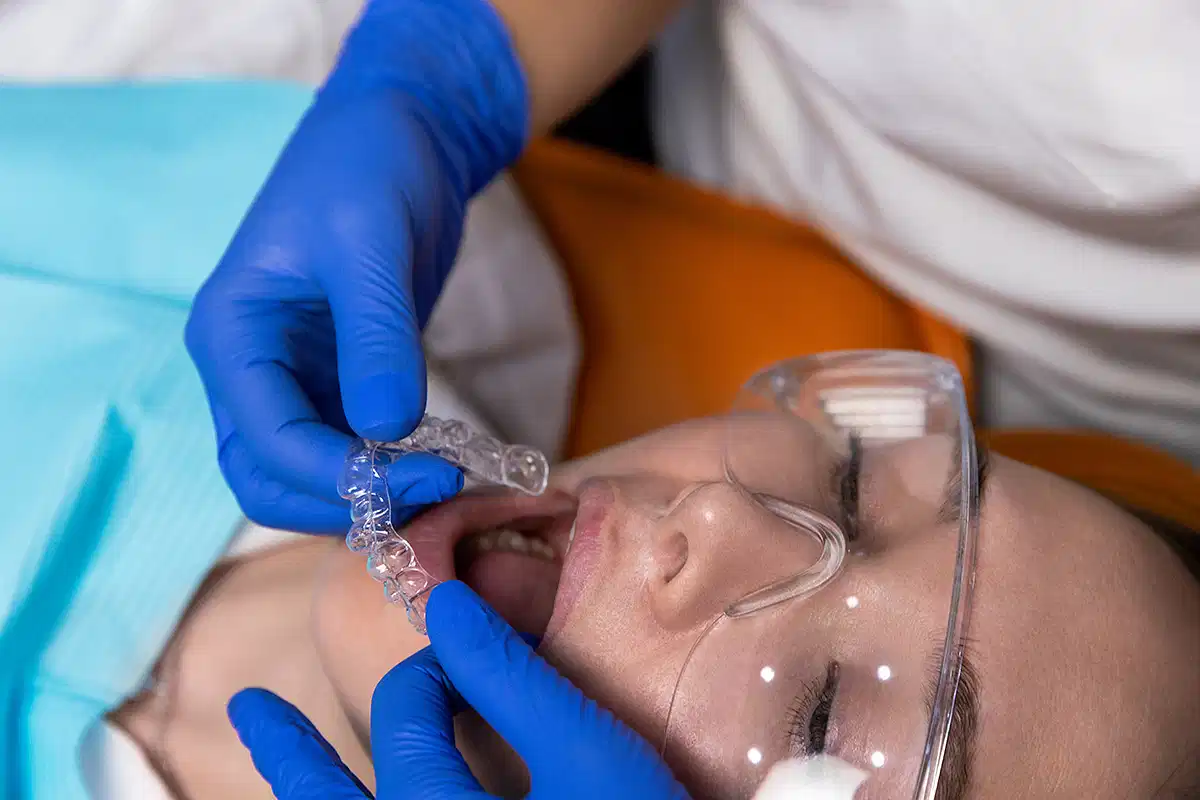 المرشح المناسب لتقويم إنفيزالاين في الامارات