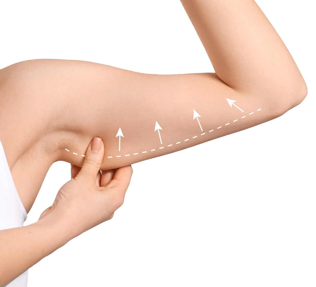 عملية شد الذراعين في الامارات