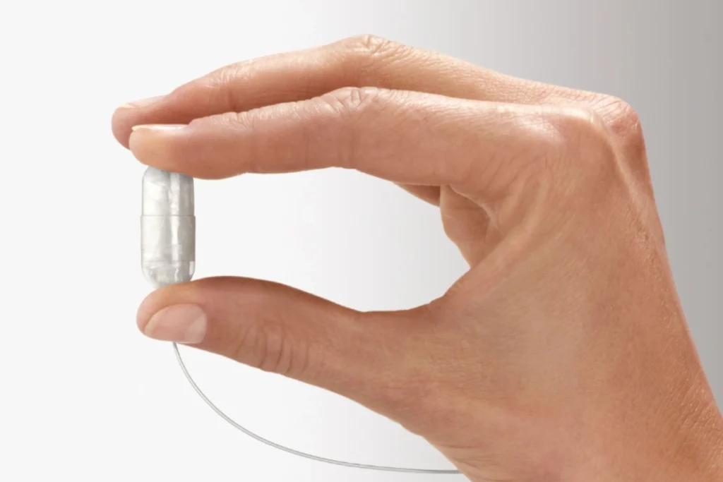 وصف تقنية الكبسولة في عيادة الكبسولة الذكية في الامارات