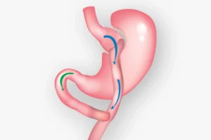 عيادة تحويل المسار في الامارات