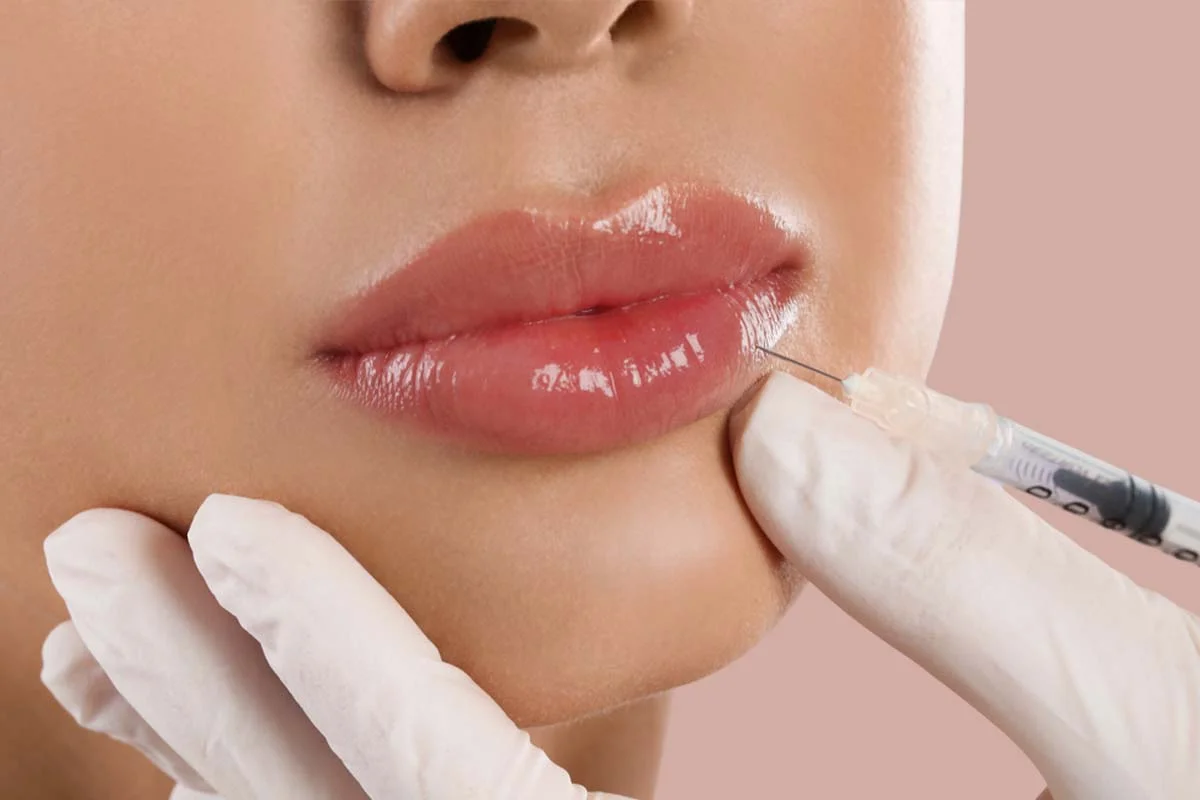 عيادة فيلر الشفاه في الامارات