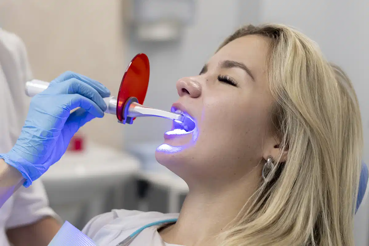 أفضل مركز تبييض الأسنان في الامارات