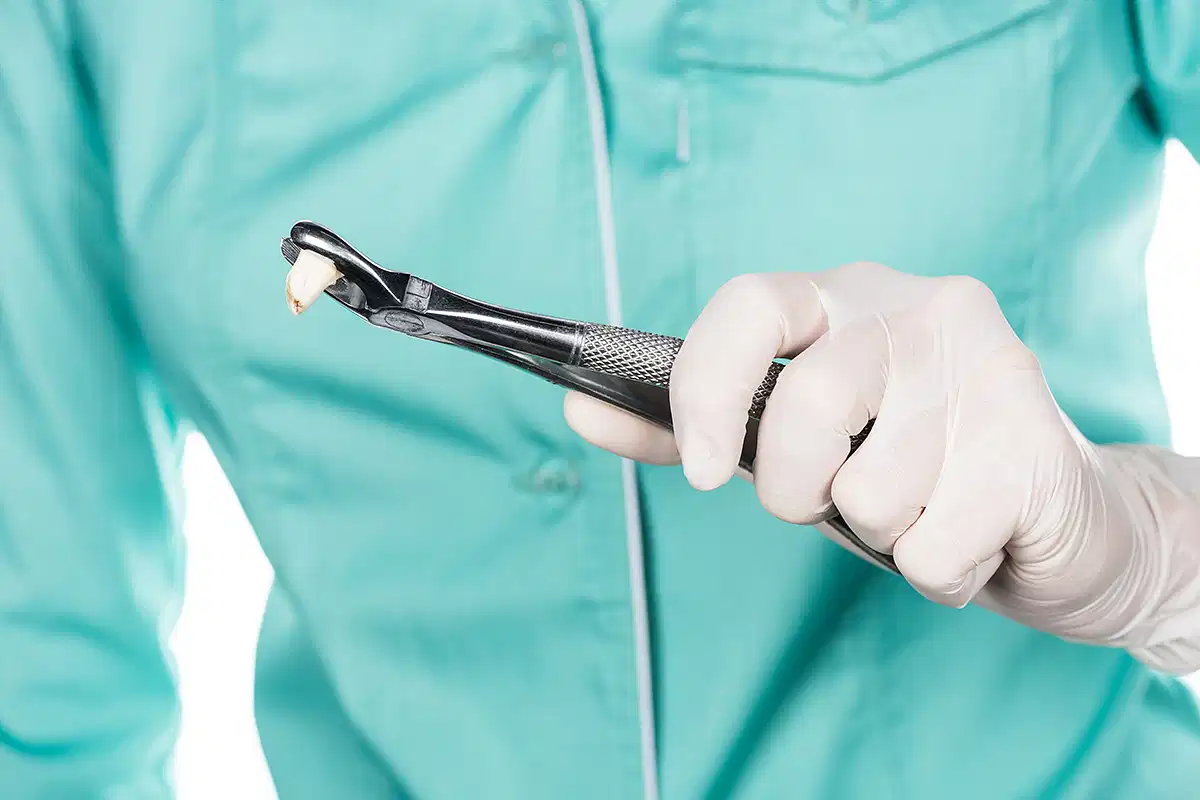 دور دكتور خلع الأسنان في الإمارات في تحديد نوع المعالجة السنية