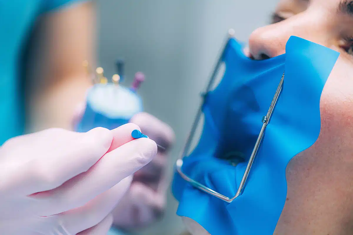 عيادة حشوات الأسنان في الامارات