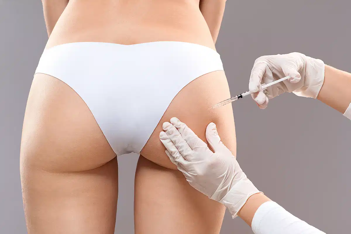 التحضير للإجراء في عيادة فيلر المؤخرة في الامارات