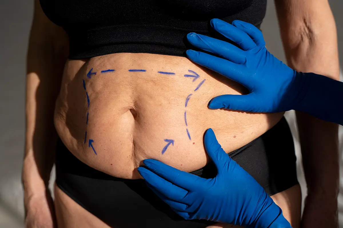 كبسولة بالون المعدة في الامارات