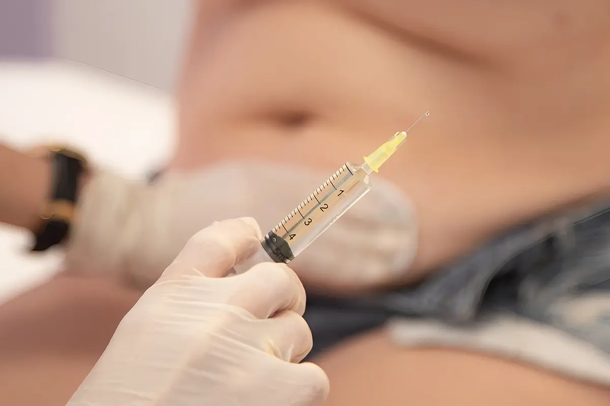 فهم تقنية تذويب الدهون بالإبر