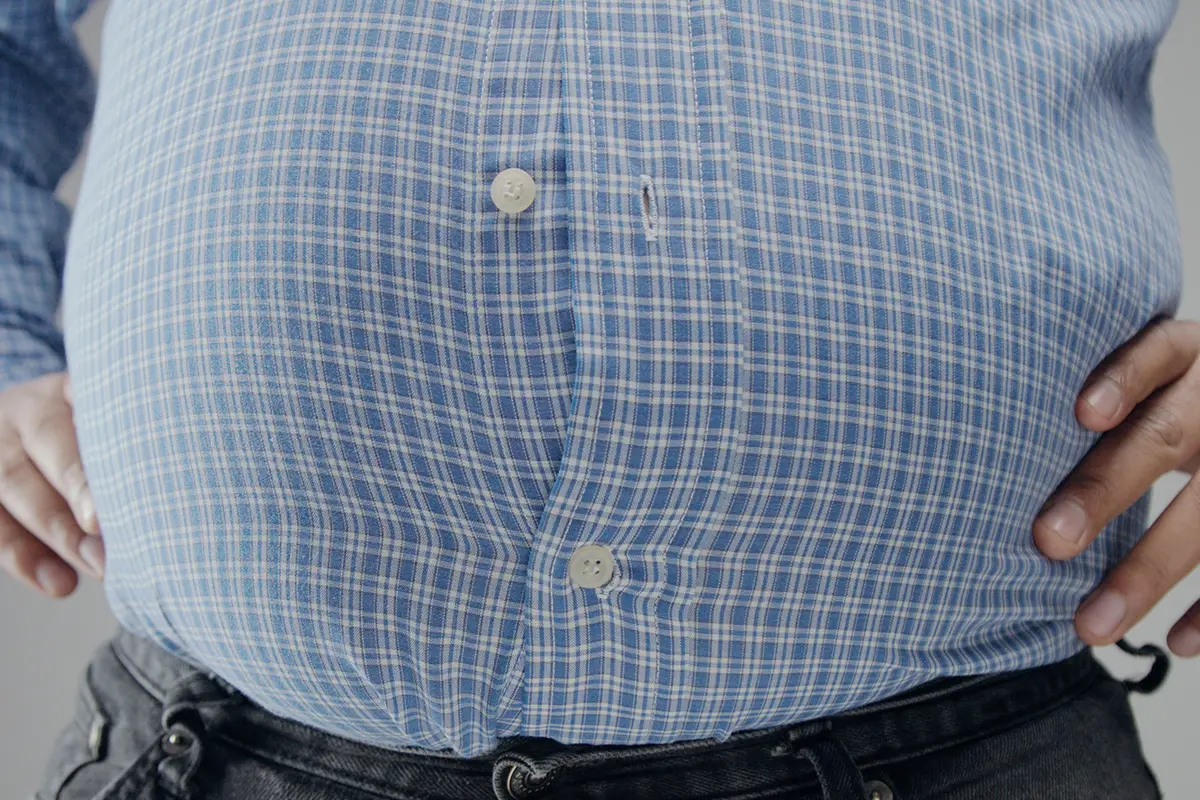 ما الفرق بين التكميم وتحويل المسار؟