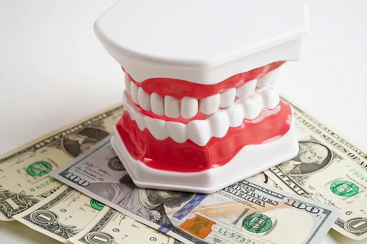 الإجراء الاحترافي لتنظيف الأسنان خطوة بخطوة