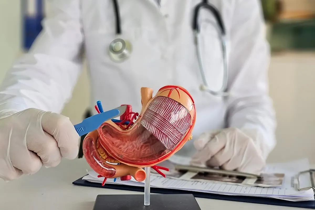 عملية تدبيس المعدة كإجراء قديم