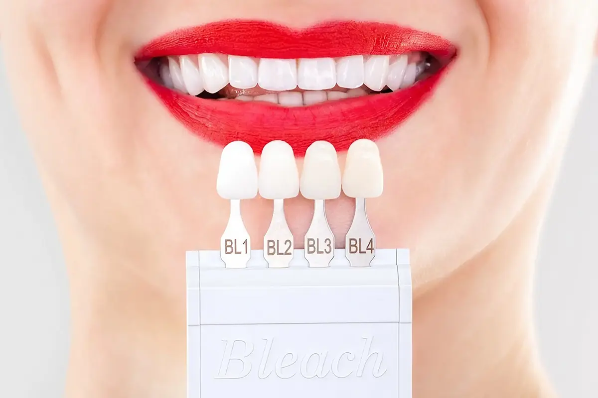 أنواع درجات الوان ابتسامة هوليود