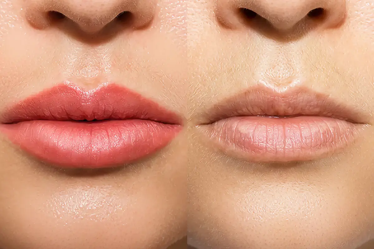 مركز توريد الشفايف في الامارات