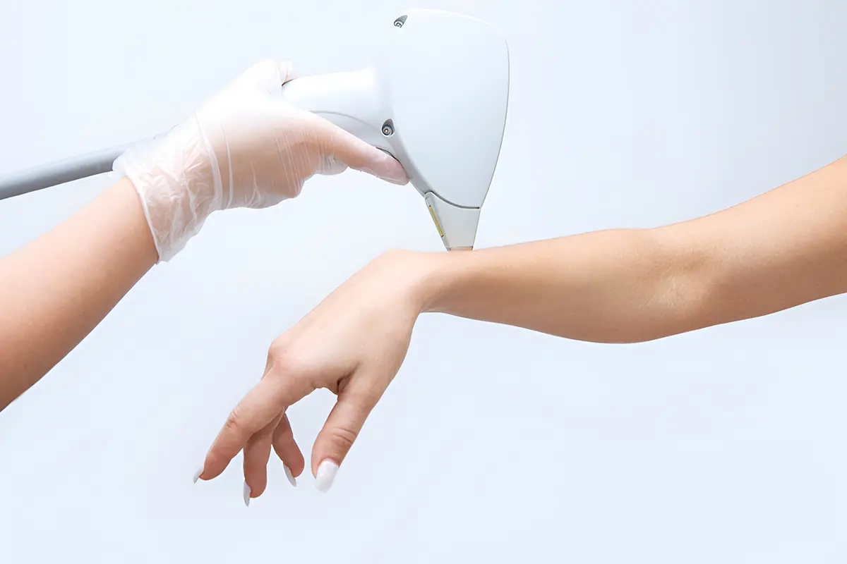 لماذا يتجه الرجال نحو مركز ليزر اليدين في الامارات؟