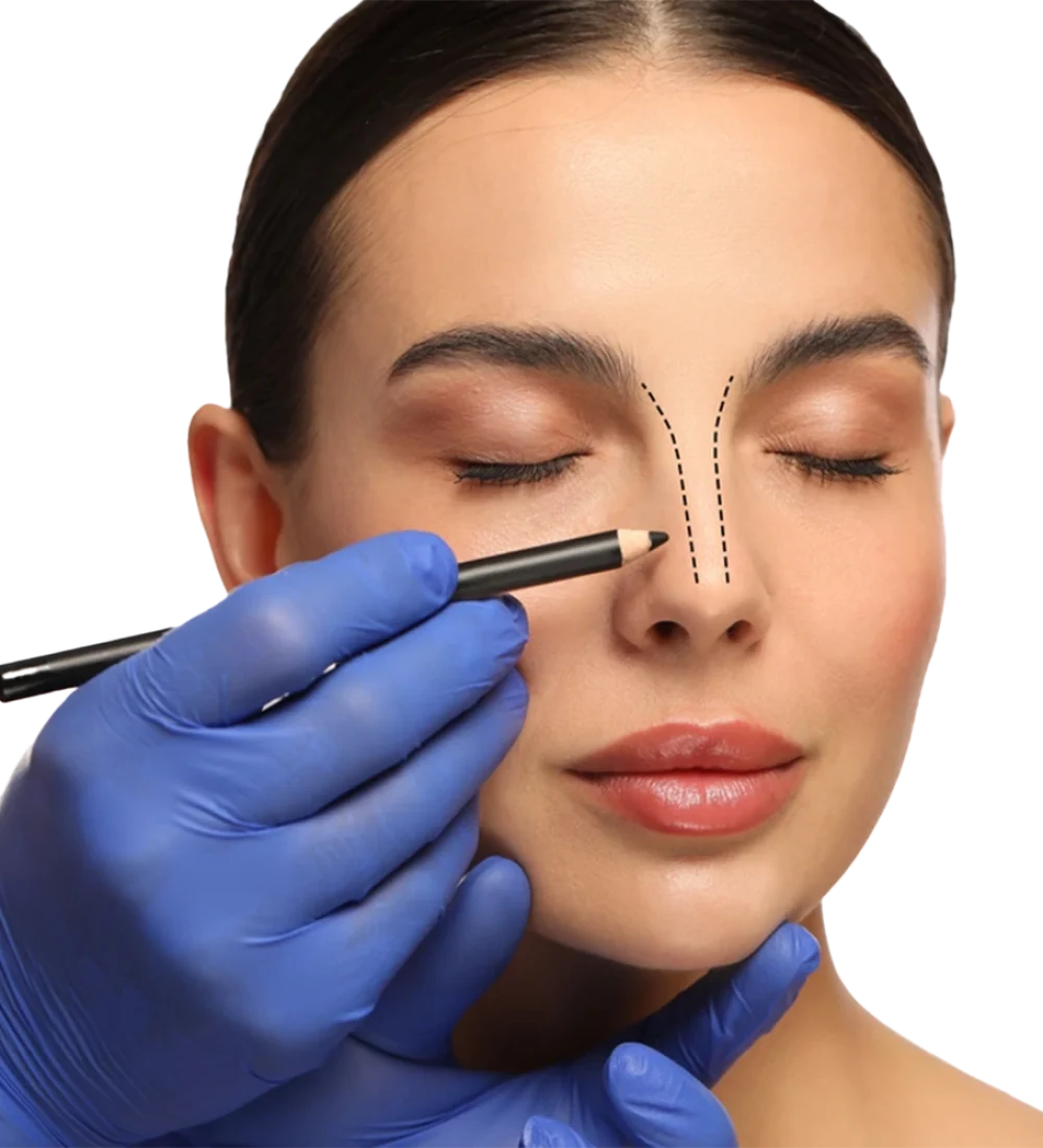 تجميل الأنف