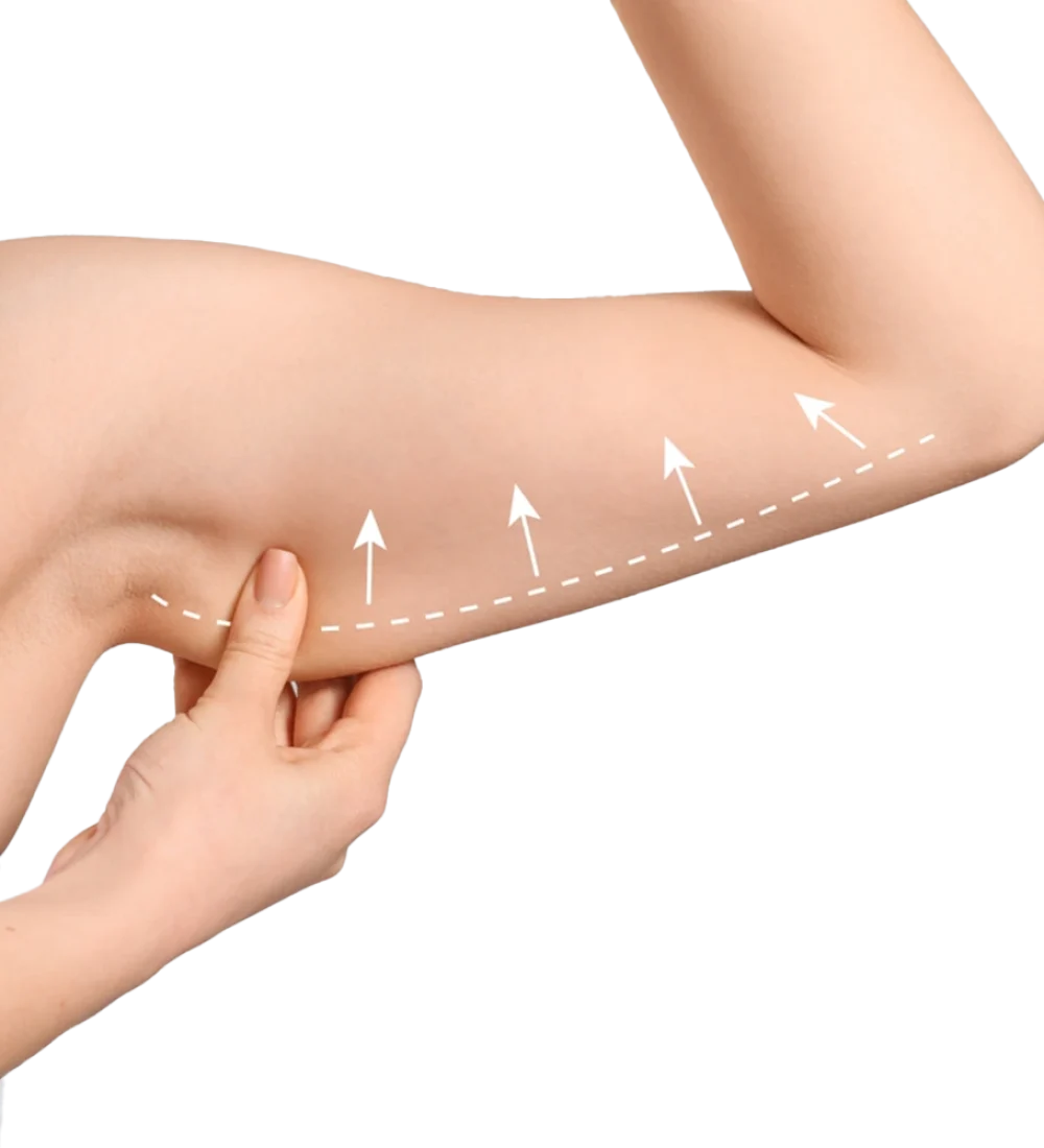 شد الذراعين